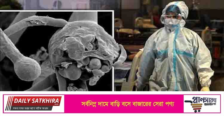 দেশে দুজনের শরীরে ‘ব্ল্যাক ফাঙ্গাস’ শনাক্ত