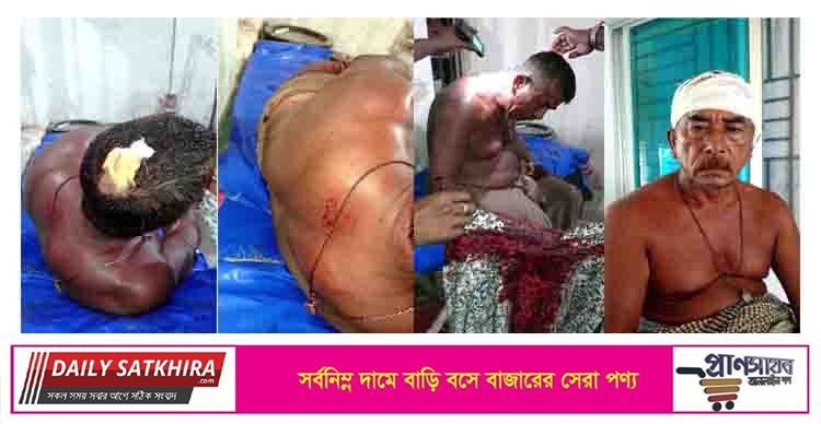 কলারোয়ায় সাতক্ষীরা এক্সপ্রেসের ড্রাইভারকে হত্যা চেষ্টার অভিযোগ