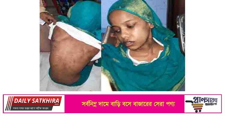 কিশোরী গৃহকর্মীকে অমানুষিক নির্যাতনের অভিযোগ