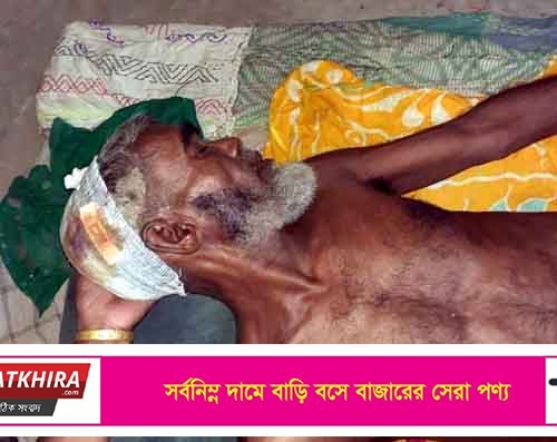 গাবুরায় তুচ্ছ ঘটনাকে কেন্দ্র করে বৃদ্ধকে মারপিট হাসপাতালে চিকিৎসাধীন 