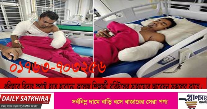 ব্রহ্মরাজপুরে বিদ্যুৎ স্পৃষ্টে হাত হারানো কলেজ শিক্ষার্থী বার্ন ইউনিটে ভর্তি : সাহায্যের আবেদন
