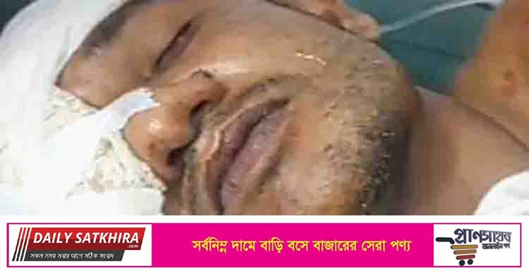 ইউএনও’র নিরাপত্তাকর্মীদের গুলিতে চোখ হারালেন সরকারি দলের ২ নেতা!