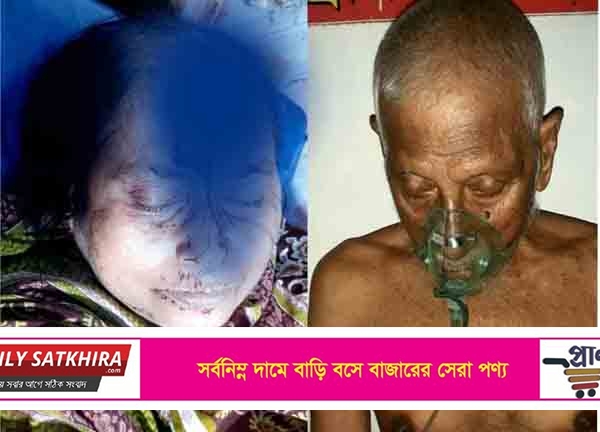 অজ্ঞান পার্টির হামলায় কা‌লিগ‌ঞ্জে এক পরিবারের দু’জন জখম