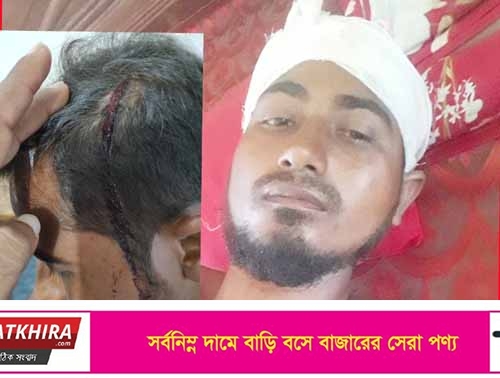 সাতক্ষীরায় দুর্বৃত্তের আঘাতে স্কুল শিক্ষক আহত