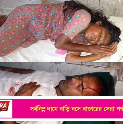 শ্যামনগরে বংশীপুরে আ’লীগের ২ গ্রুপের সংঘর্ষে আহত-২