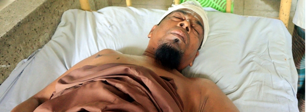 তালায় জমি-জমা বিরোধে স্বামী-স্ত্রীকে পিটিয়ে জখম