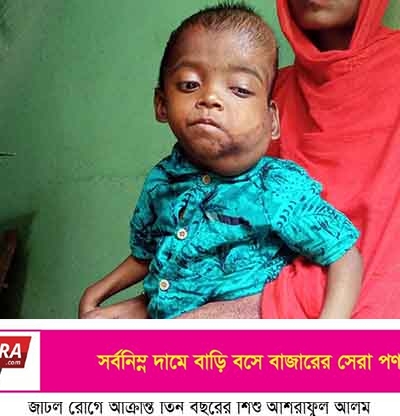 সাতক্ষীরায় তিন বছরের শিশু সন্তানের চিকিৎসায় সাহায্যের আবেদন শ্রমিক পিতার