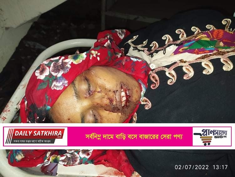 সাতক্ষীরা সদর হাসপাতালে পড়ে আছে সড়ক দুর্ঘটনায় নিহত অজ্ঞাত নারীর লাশ
