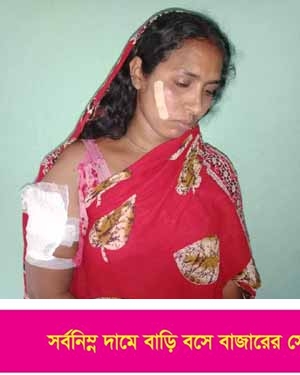 দেবহাটায় প্রতিপক্ষের হামলায় এক গৃহবধু আহত
