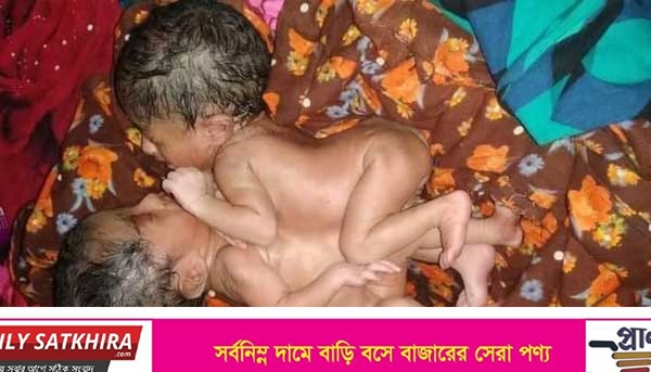 শ্যামনগরের আলোচিত একটি হৃদপিন্ড নিয়ে জন্ম নেওয়া দুই শিশুর মৃত্যু