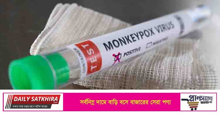 মাঙ্কিপক্স ছড়িয়েছে ৩০ দেশে, শনাক্ত ৫৫০
