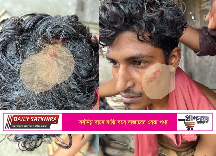 সাতক্ষীরায় জমি জমা সংক্রান্ত বিরোধের জেরে ৪জনকে জখমের অভিযোগ