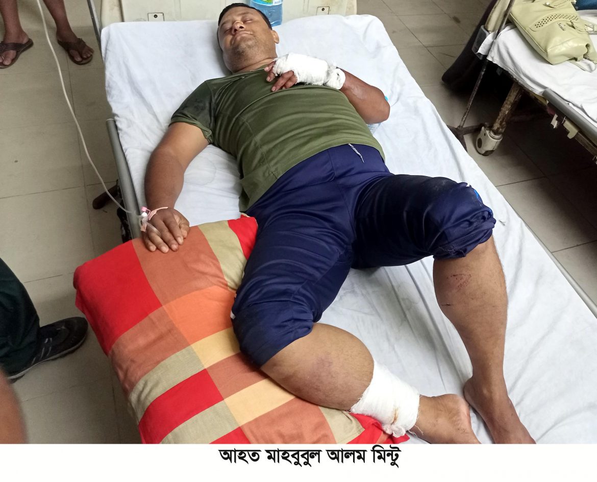 সাতক্ষীরায় এক যুবককে হকিস্টিক পিটিয়ে হাত পা ভেঙে দেওয়ার অভিযোগ
