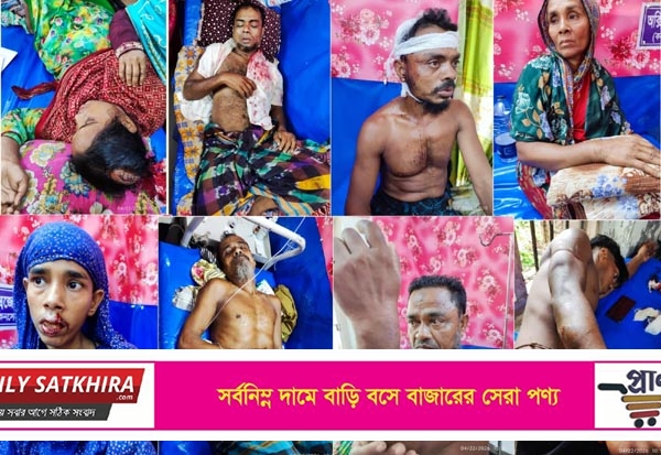 সাতক্ষীরা’র শ্যামনগরে পূর্ব শত্রুতার জের ধরে সংঘর্ষে আহত ১৪