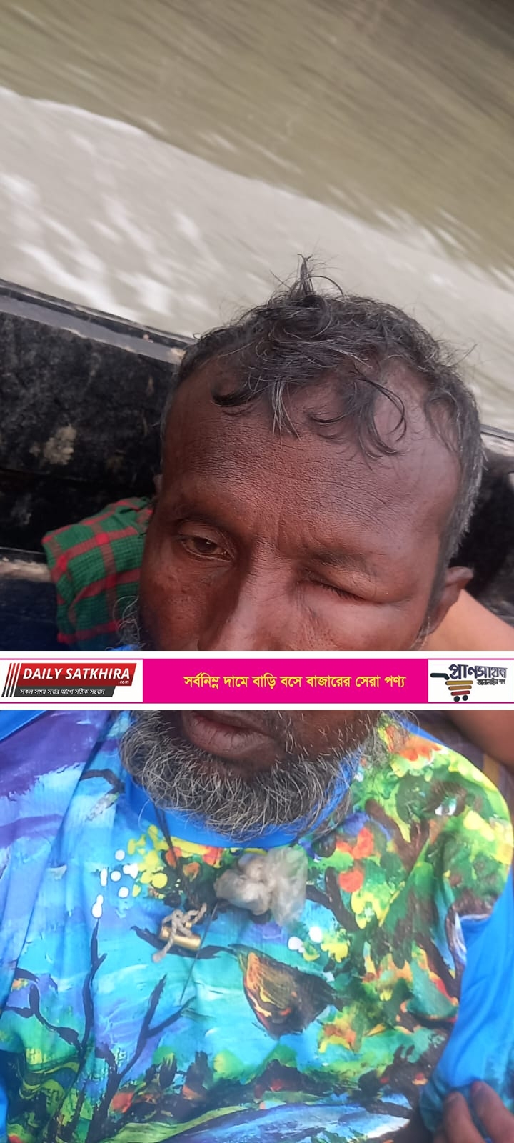 সুন্দরবনে সাপের কামড়ে মৌয়ালী আহত : হাসপাতালে ভর্তি